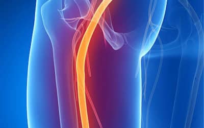 L&rsquo;ostéopathe face à la sciatique : méthodes et bienfaits