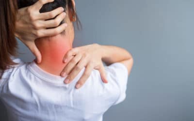 La névralgie cervico-brachiale (NCB)